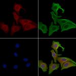 PRKD3 Polyclonal Antibody