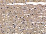 PRKD3 Antibody in Immunohistochemistry (Paraffin) (IHC (P))