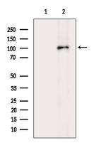 PRKD3 Antibody in Western Blot (WB)