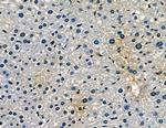 SRMS Antibody in Immunohistochemistry (Paraffin) (IHC (P))