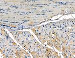 SRMS Antibody in Immunohistochemistry (Paraffin) (IHC (P))