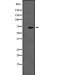 TNK1 Antibody in Western Blot (WB)