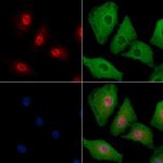 TSSK3 Polyclonal Antibody