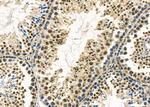 TSSK3 Antibody in Immunohistochemistry (Paraffin) (IHC (P))