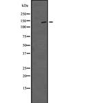 TTBK1 Polyclonal Antibody
