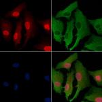 SGK494 Polyclonal Antibody