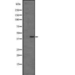 CMKLR1 Polyclonal Antibody