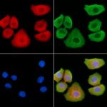 HOR5'Beta13 Antibody in Immunocytochemistry (ICC/IF)