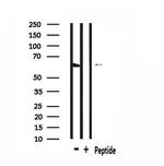GPR148 Polyclonal Antibody