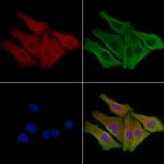 GPR43 Polyclonal Antibody