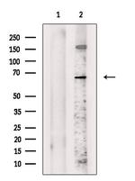 Frizzled 10 Polyclonal Antibody