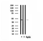 GNRHR2 Polyclonal Antibody