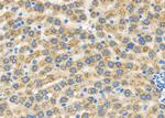 GPR33 Antibody in Immunohistochemistry (Paraffin) (IHC (P))