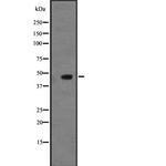 NMUR2 Polyclonal Antibody