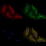 OR2T8/OR2T12/OR2T33 Polyclonal Antibody