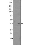 OR4C45 Polyclonal Antibody