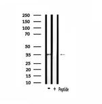 OR4F3/OR4F21 Polyclonal Antibody