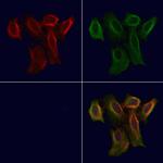 OR5AN1 Polyclonal Antibody