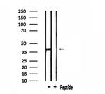 OR5H6/OR5H14 Antibody in Western Blot (WB)