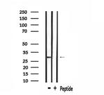 OR6C75 Polyclonal Antibody