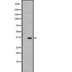 OR1J4 Polyclonal Antibody
