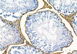 OR1J2/OR1N2 Antibody in Immunohistochemistry (Paraffin) (IHC (P))