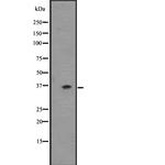 OR2T6 Antibody in Western Blot (WB)