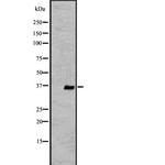 OR2V2 Polyclonal Antibody