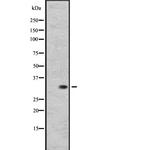 RGR Polyclonal Antibody
