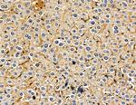 PJCG2 Antibody in Immunohistochemistry (Paraffin) (IHC (P))