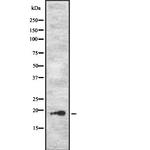 PJCG2 Antibody in Western Blot (WB)