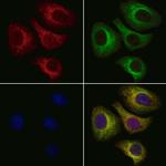 ALAS1 Polyclonal Antibody