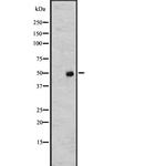 TUBA4A Polyclonal Antibody