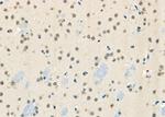 BRD4 Polyclonal Antibody