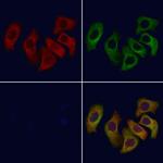 CCR9 Polyclonal Antibody