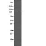 DGCR8 Polyclonal Antibody