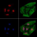 FUBP1 Antibody in Immunocytochemistry (ICC/IF)