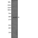 HAPLN1 Polyclonal Antibody