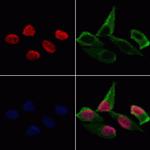 HDAC11 Polyclonal Antibody