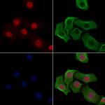 H2AK9ac Polyclonal Antibody