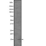 H3K14me1me2me3 Antibody in Western Blot (WB)