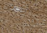KIFC1 Antibody in Immunohistochemistry (Paraffin) (IHC (P))