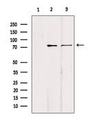 KIFC1 Antibody in Western Blot (WB)