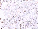 LRP1 Polyclonal Antibody
