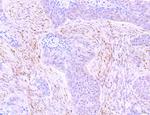 LRP1 Antibody in Immunohistochemistry (Paraffin) (IHC (P))