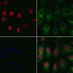 OTX1 Polyclonal Antibody