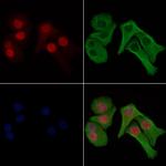 Phospho-Histone H1.3 (Thr18) Antibody in Immunocytochemistry (ICC/IF)