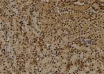 Phospho-Histone H1.3 (Thr18) Antibody in Immunohistochemistry (Paraffin) (IHC (P))