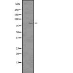 PIK3R2 Antibody in Western Blot (WB)