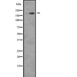 Phospho-EGFR (Tyr1092) Antibody in Western Blot (WB)